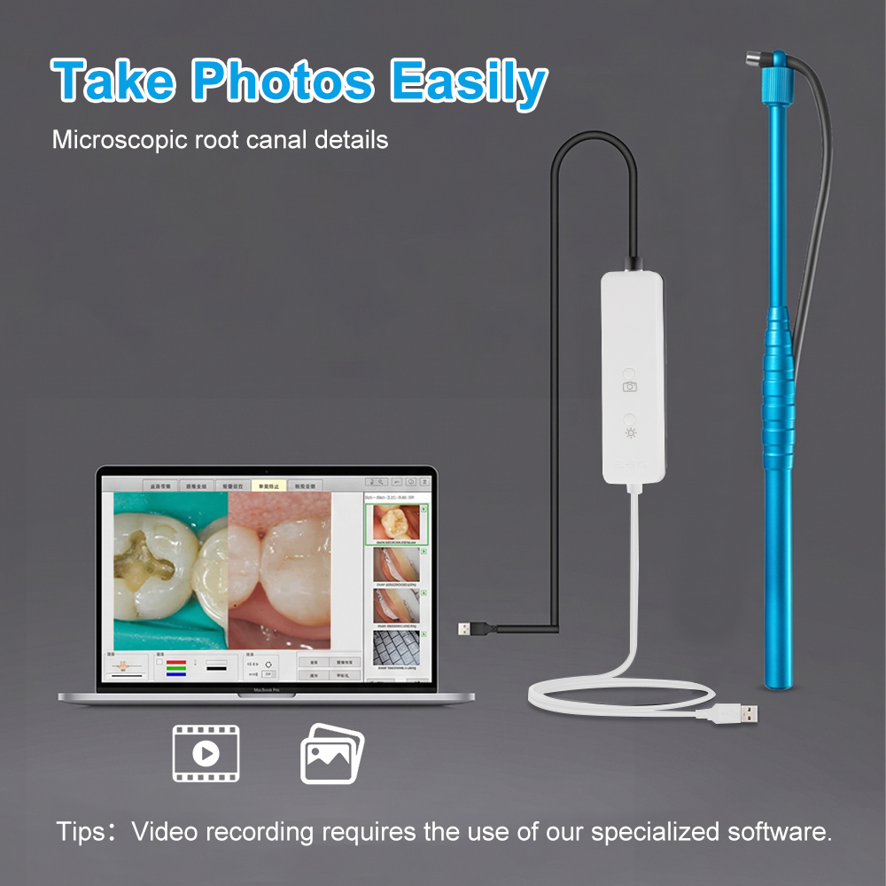 5MP Micro Intraoral Camera Den - Mini Pc Windows recensie en prijs